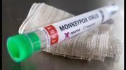 آخرین اخبار مربوط به آبله میمونی و تب کریمه کنگو در کشور 